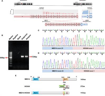 A Recurrent Cryptic MED14-HOXA9 Rearrangement in an Adult Patient With Mixed-Phenotype Acute Leukemia, T/myeloid, NOS